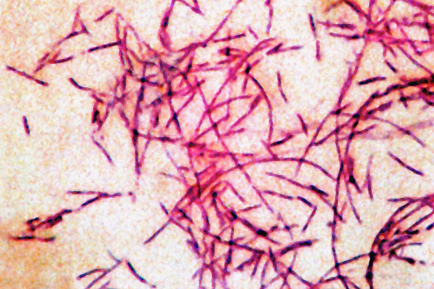 4th person dies from Legionnaires' disease in New York City cluster