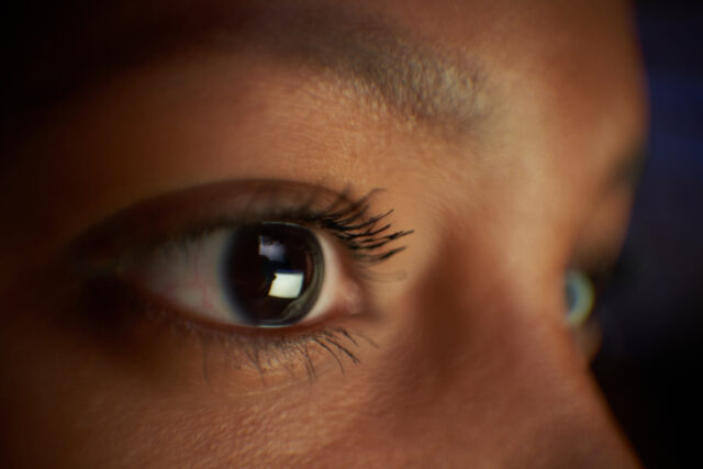 Why are vertebrate eyes so different from those of other animals?