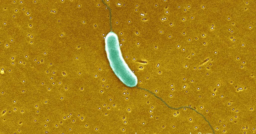 Flesh-eating bacteria has killed 5 in Louisiana this year, officials say