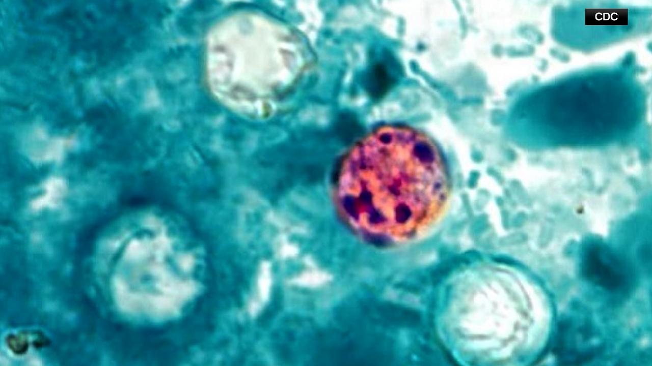 Parasite outbreak spreads nationwide