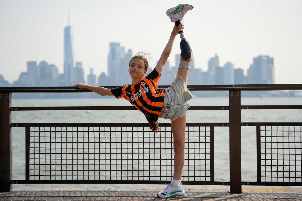 After losing her leg to a Russian missile attack, this 10-year-old Ukrainian gymnast is telling her story through dance