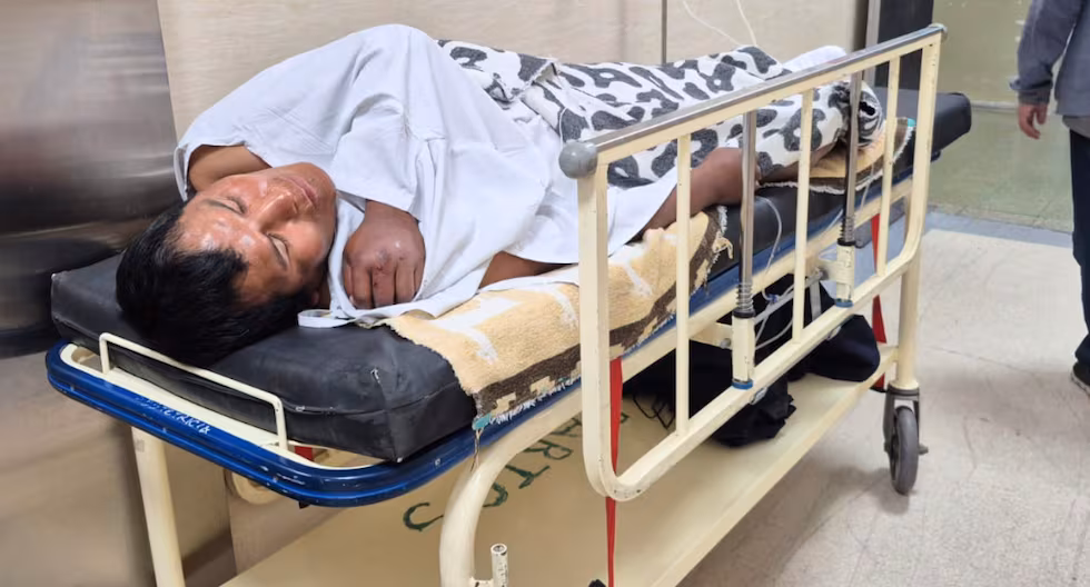 Arequipa: Ladrones secuestran a indigente y le rompen la pierna al ver que no tenía dinero ni tarjetas