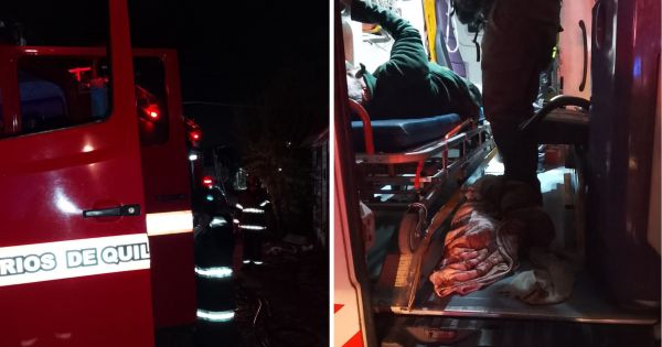 Quilmes Este: un hombre herido por un incendio