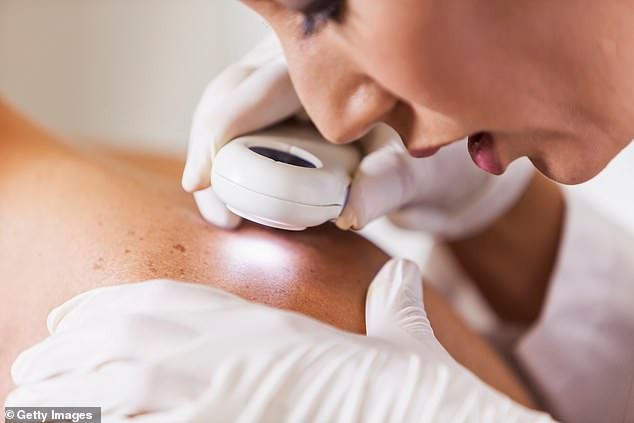 The unexpected place you can get melanoma that isn't your skin... and it has nothing to do with the sun