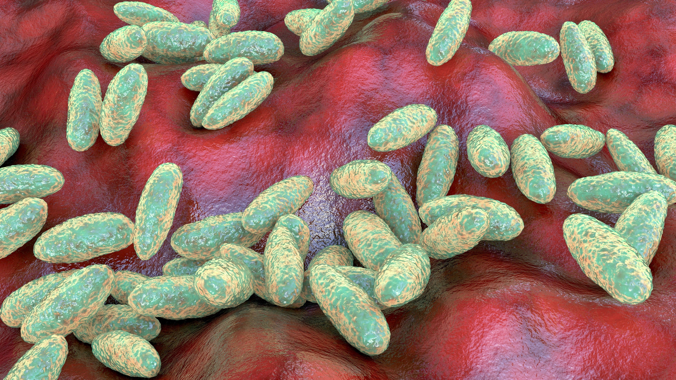 US presses Russia for answers after suspected fatal plague case surfaces