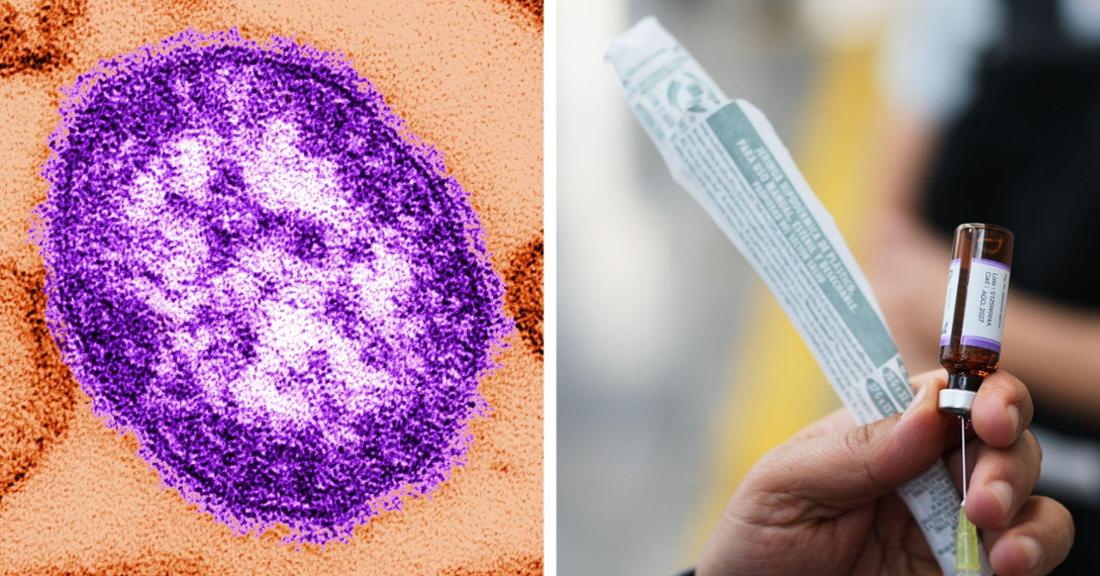 Infection wave sweeps through the USA: Trump administration criticized – virus also returns to Europe