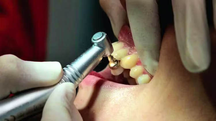 France/LuxembourgUn faux dentiste présumé en France aurait sévi au Luxembourg