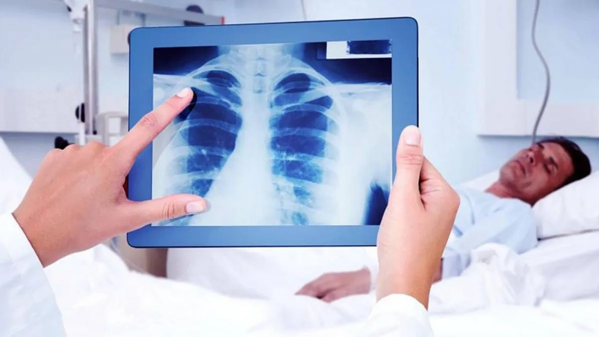 Tuberculosis en Santa Fe: los casos aumentaron un 33 % en 2026 y es una de las provincias más afectadas
