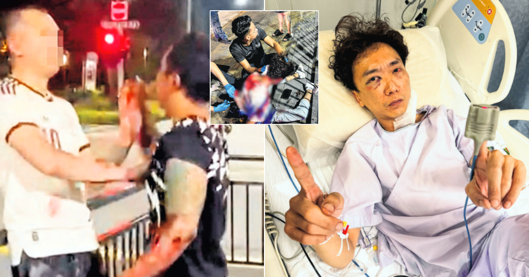 Orchard fight: Victim, 39, claims knife attack caused neck wound near carotid artery & fractured cheekbone