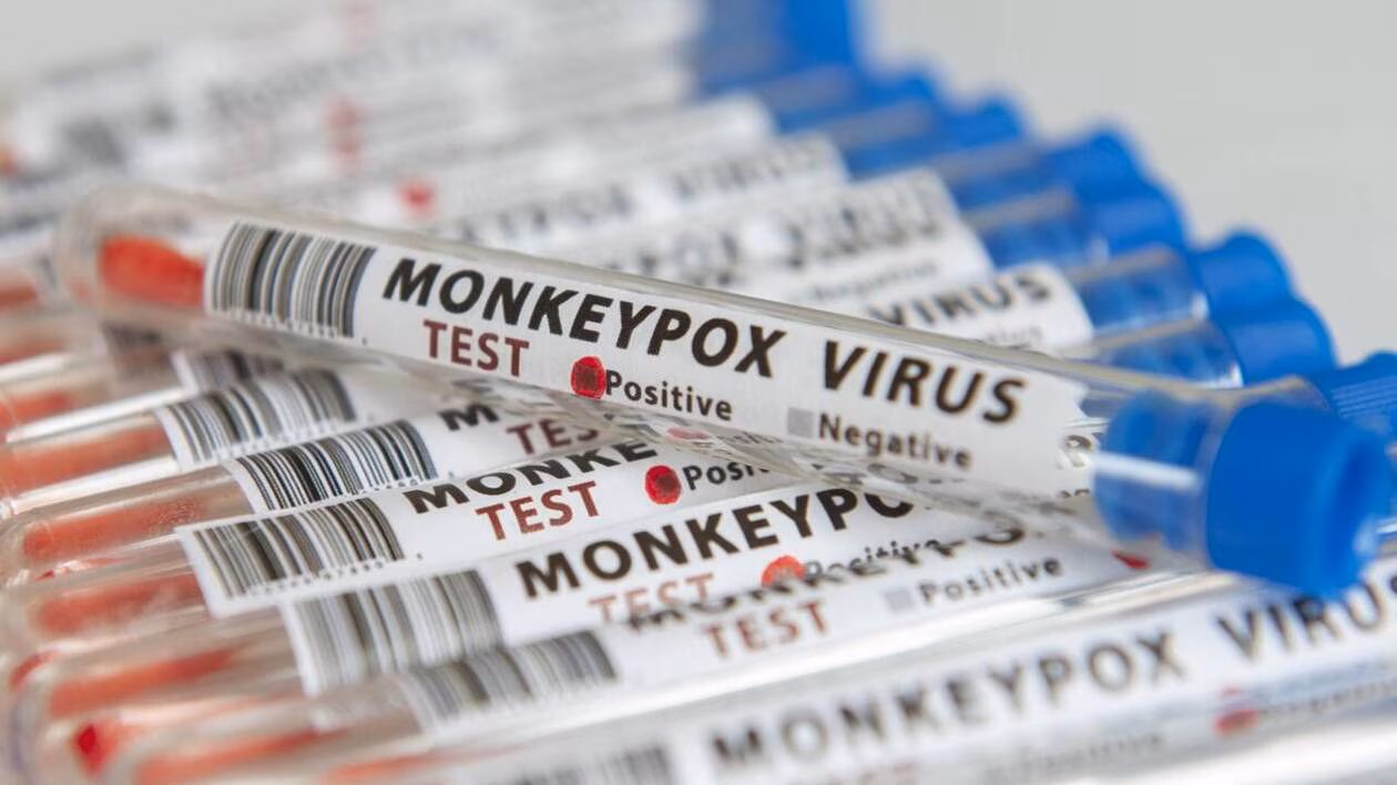 Deux virologues inculpés aux États-Unis pour avoir tenté d’importer le virus mpox depuis le Congo-Brazzaville