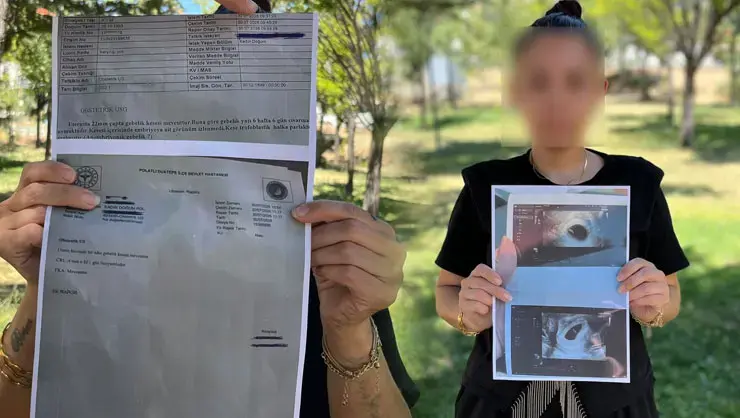 'Boş gebelik' deyip 30 bin lira istediler! 7 haftalık hamile Eda'nın ısrarı bebeğini kurtardı