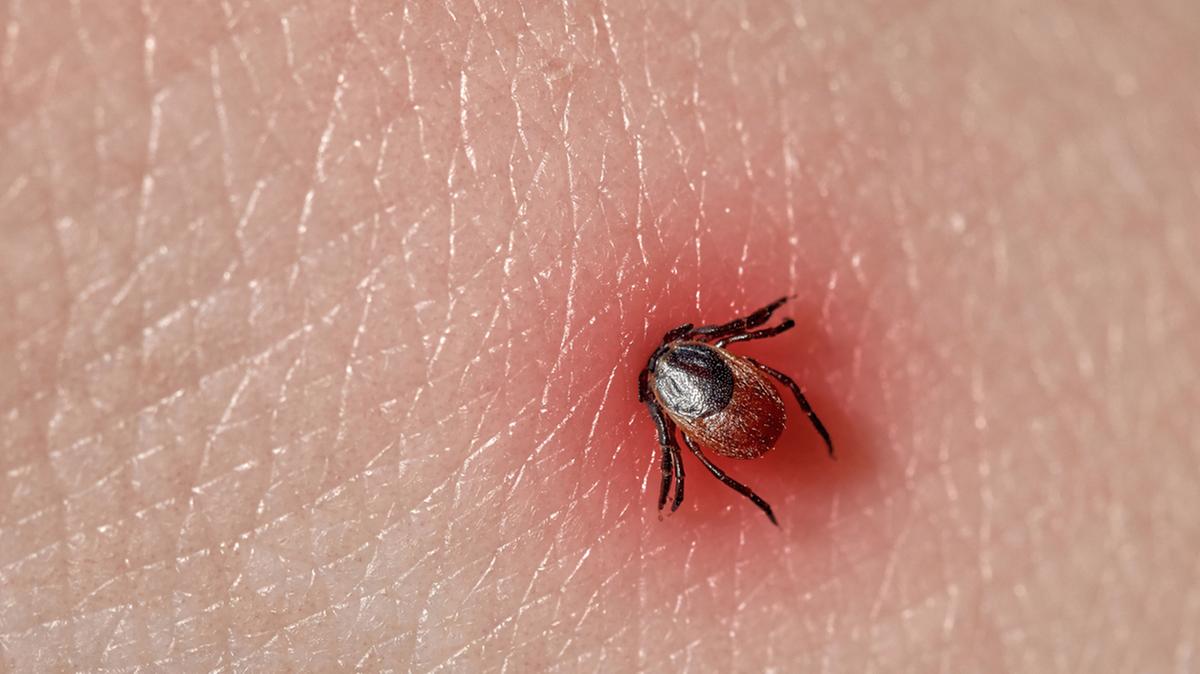 Le zecche sono in aumento. Come toglierle e cosa c’è da sapere per proteggersi - QNSalus