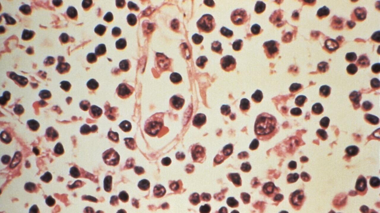 WHO chief due in Canaries to coordinate hantavirus ship evacuation