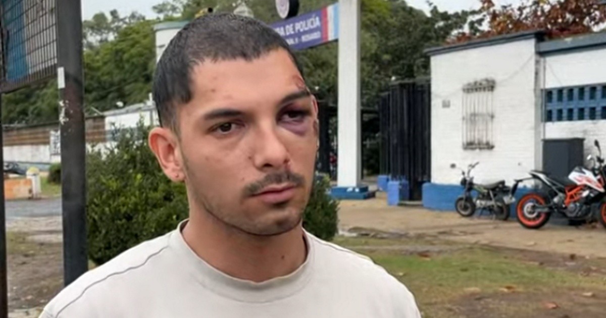 Salvaje agresión en Rosario: joven denunció que un conocido lo arrastró con su auto tras pelearse por una c...