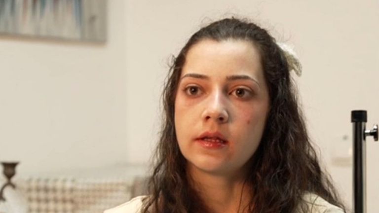 Gang-rape victim, 25, dies by euthanasia after father's legal challenge fails
