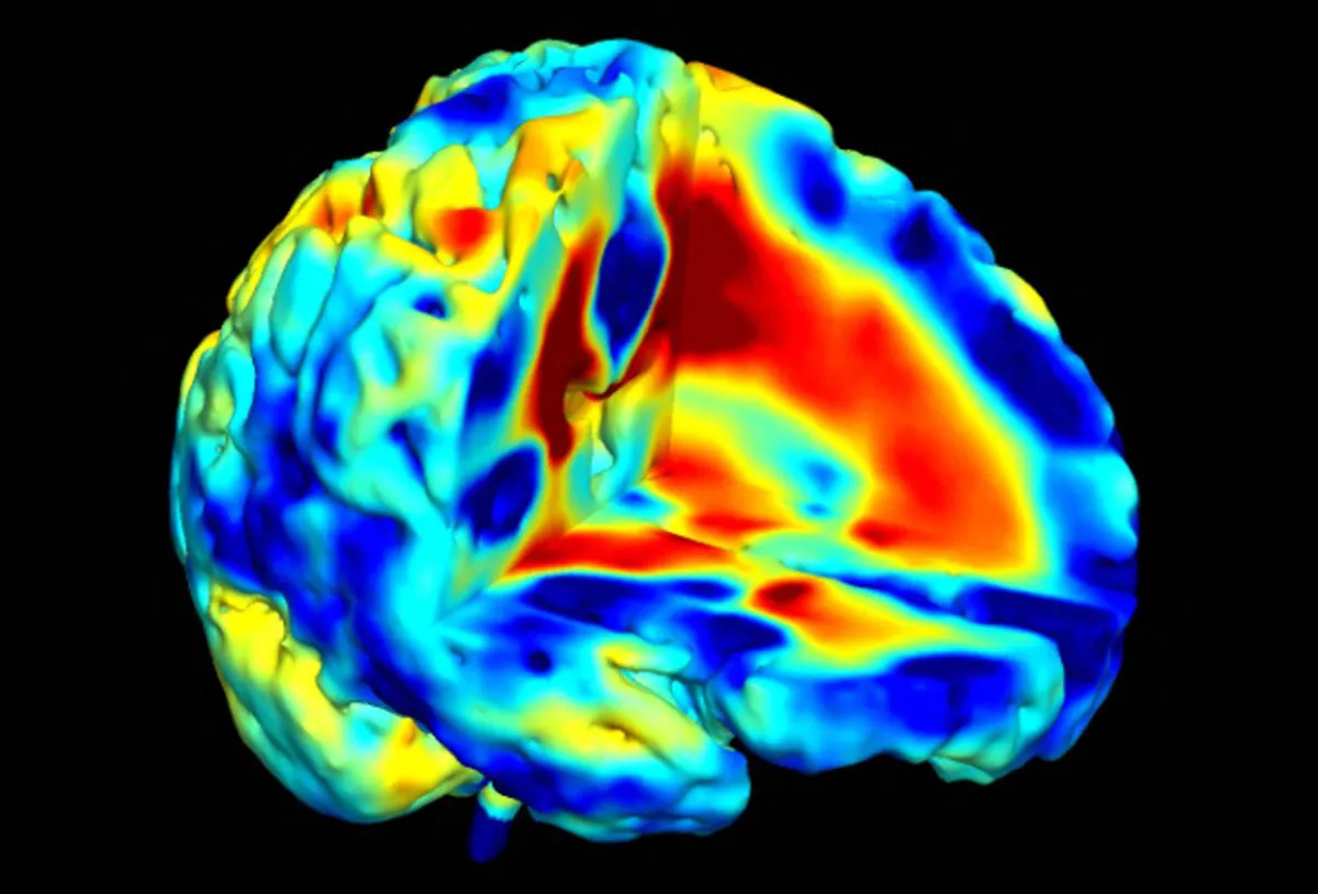 A brain scan before a prescription? Geneva’s bet on precision psychiatry