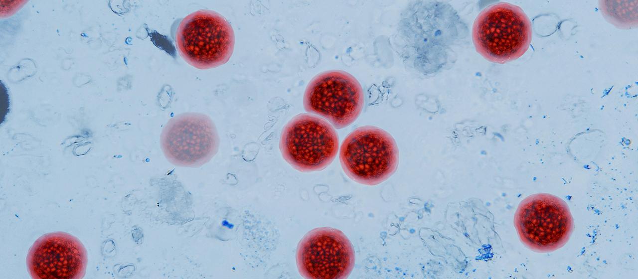Cyclospora-Parasit: Über 10.000 Durchfall-Infektionen in den USA