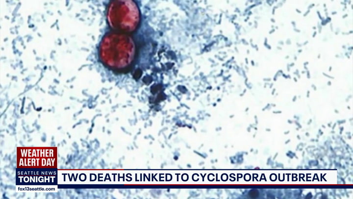 Largest cyclospora outbreak expands to 15 states with over 10, 000 cases