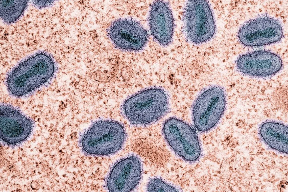 Mpox can infect and replicate in the brain, US health researchers say in fatal HIV case