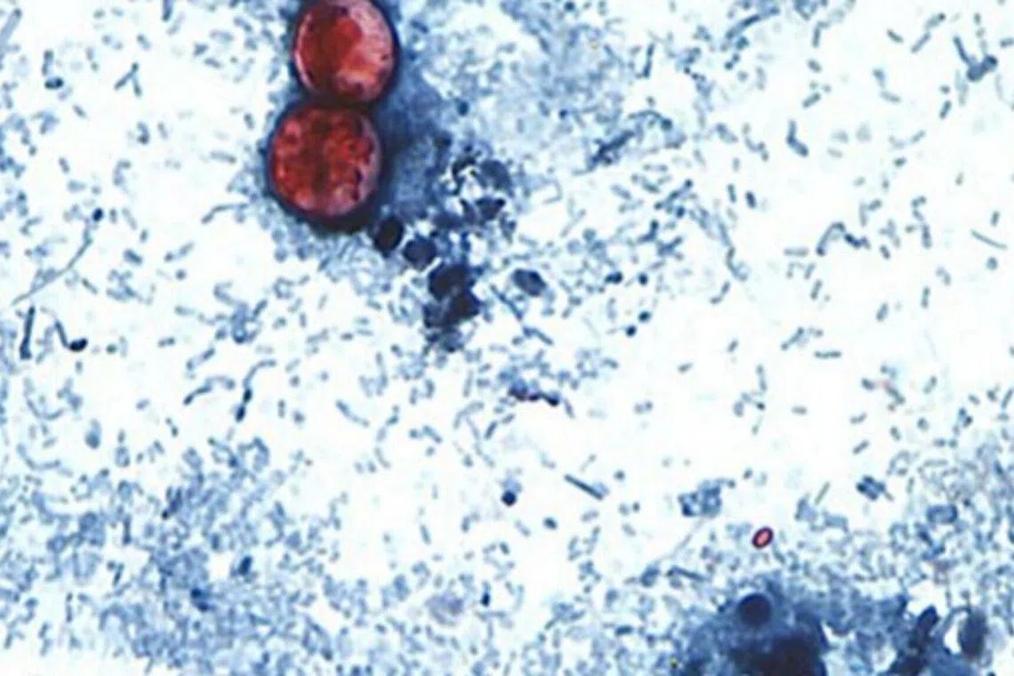 Parasite causing severe diarrhoea spreads in US Midwest, NYC