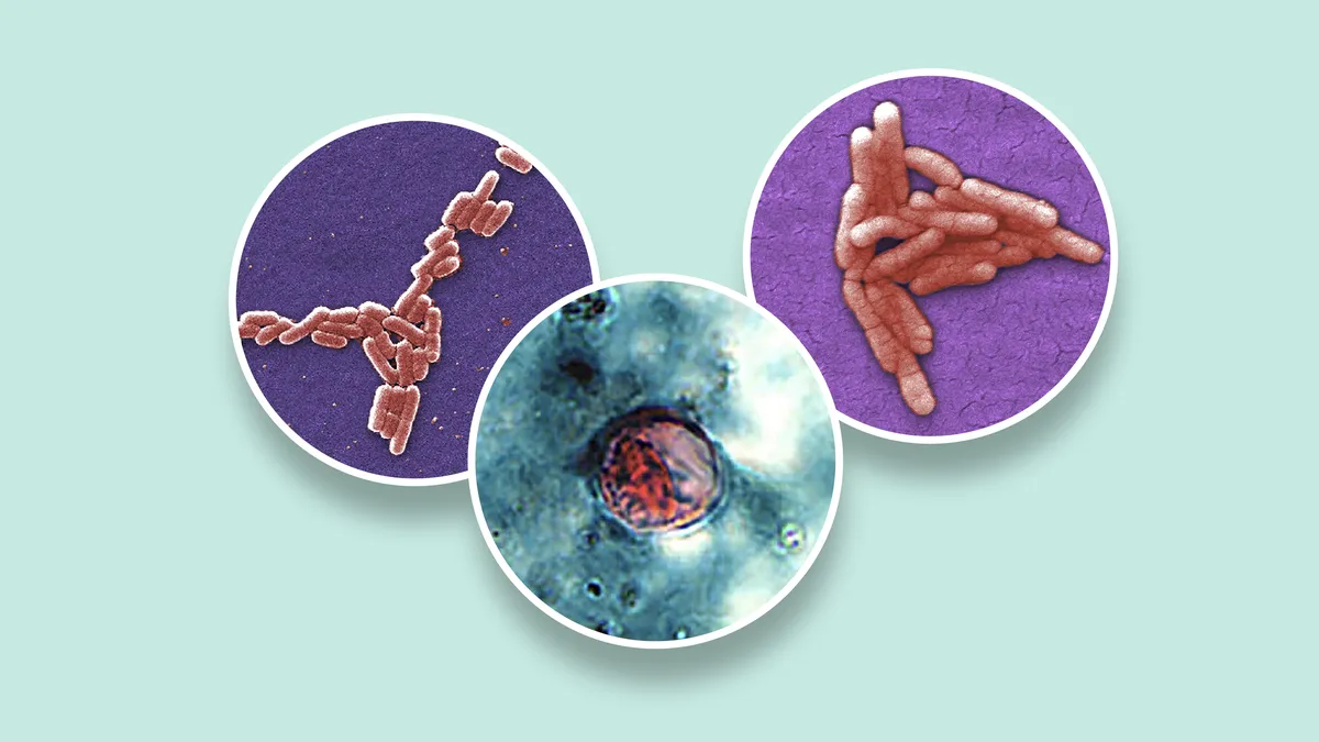 Cyclosporiasis vs other GI illnesses: Key differences explained