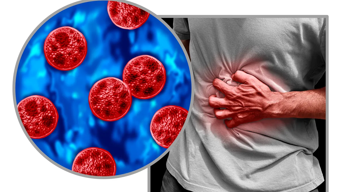 Michigan reports first 2 US deaths connected with cyclosporiasis outbreak
