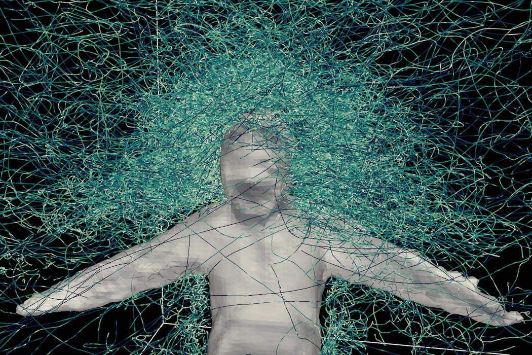 Hundreds of hungry mosquitoes, a student volunteer and a mesh suit helped us figure out how these deadly insects reach their targets