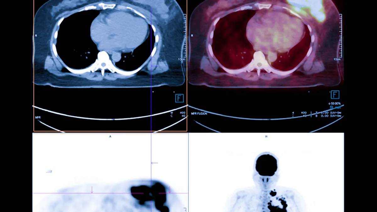 8th-grader makes discovery about tumors during school science project