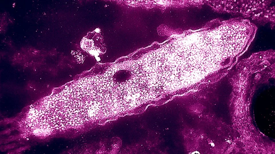 Two deaths reported in New York City Legionnaires’ disease cluster